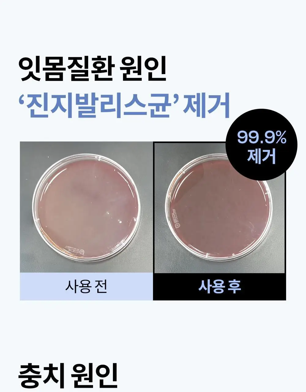 [진지발리스균 99.9%제거] 언파 차차 에너지 잇몸 치약 (100g) 상세페이지 10